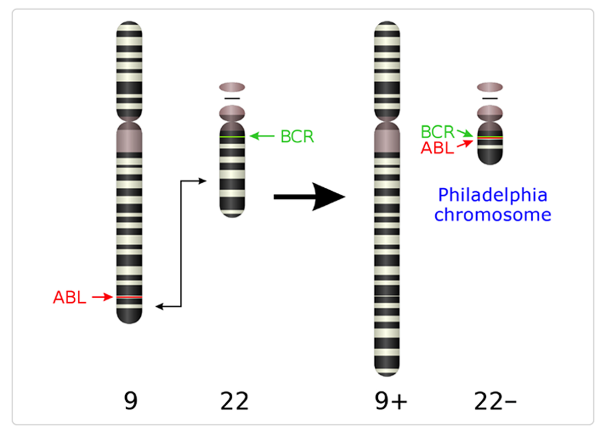 Diagram showing the translocated components of the Philadelphia chromosome